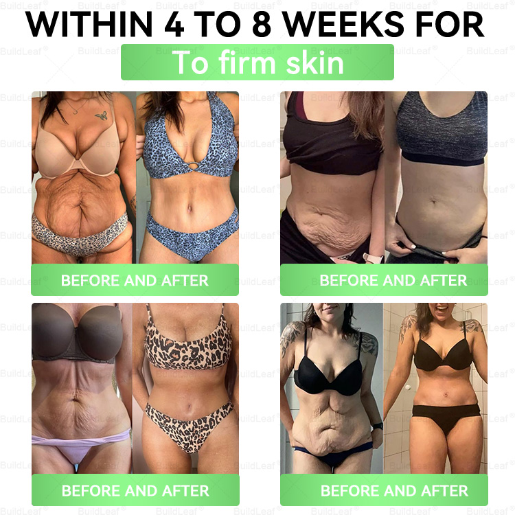 Arrivalla™ GLP-1 8-in-1 Slim & Healthy Oral Solution (Once a day, visible results in 7 days) ✅ Helps support weight management, cardiovascular health, diabetes, sleep apnea, gut health, and joint function — while also firming the skin and boosting energy.