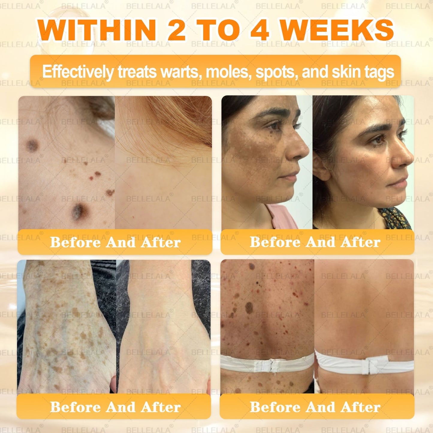 NEW & IMPROVED ✨Bellelala® 𝖡𝖾𝖾 𝗏𝖾𝗇𝗈𝗆 𝖲𝗄𝗂𝗇 𝖱𝖾𝗌𝗍𝗈𝗋𝖺𝗍𝗂𝗈𝗇 𝖢𝗋𝖾𝖺𝗆