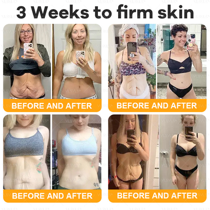 VLSVLS® Bee Venom Comprehensive Cream  👩‍⚕️⏰ LAST DAY 80% OFF (Sagging Skin, Fine Lines, Loss of Firmness, Flat Bust, Drooping Hips, and More)