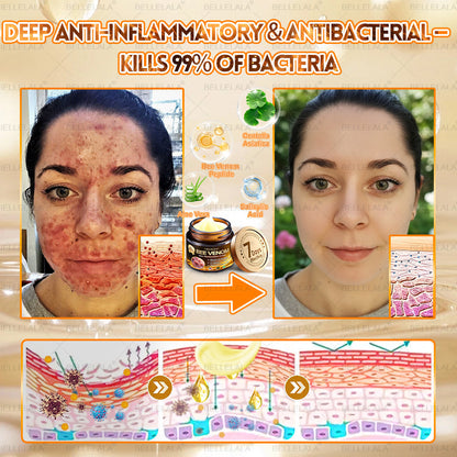 NEW & IMPROVED ✨Bellelala® 𝖡𝖾𝖾 𝗏𝖾𝗇𝗈𝗆 𝖲𝗄𝗂𝗇 𝖱𝖾𝗌𝗍𝗈𝗋𝖺𝗍𝗂𝗈𝗇 𝖢𝗋𝖾𝖺𝗆