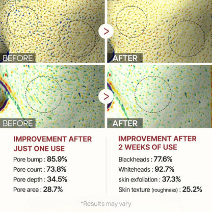 Final 3 Hours: 42% OFF🔥 Gentle Exfoliator Glow Rice Ampoule-Suitable for All Skin Types