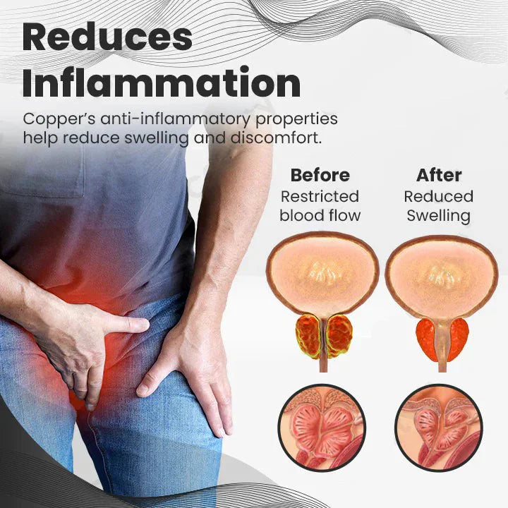 ✨Ringmiz Copper Mag Prostate Therapy Ring（Limited Time Discount 🔥 Last Day）