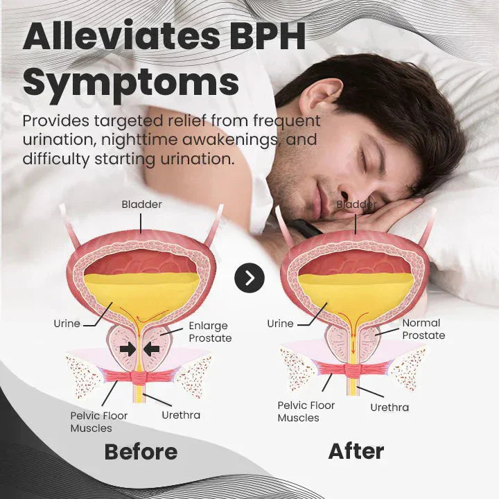 ✨Ringmiz Copper Mag Prostate Therapy Ring（Limited Time Discount 🔥 Last Day）